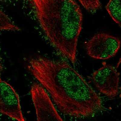 Immunocytochemistry/ Immunofluorescence: EphB2 Antibody [NBP2-56605]