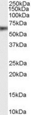 Western Blot: EphB2 Antibody [NB100-55398]