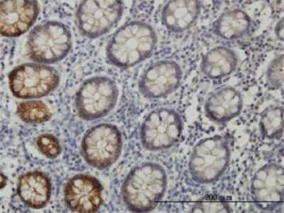 Immunohistochemistry-Paraffin: EphB3 Antibody (1B3) [H00002049-M01]
