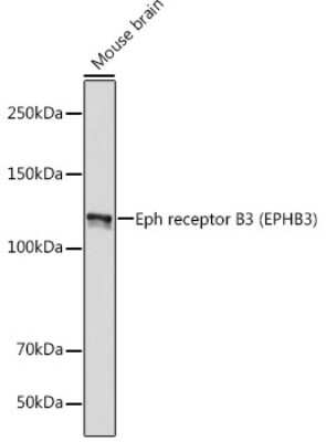 Western Blot: EphB3 Antibody (8H9P4) [NBP3-15693]