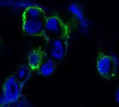 Immunocytochemistry/ Immunofluorescence: EphB4 Antibody (5B5) - BSA Free [NBP1-47434]