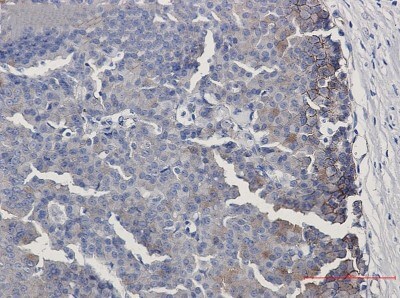 Immunohistochemistry-Paraffin: EphB4 Antibody (S04-3B0) [NBP3-19861]