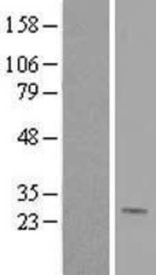 Western Blot: Ephrin-A1 Overexpression Lysate [NBL1-10142]