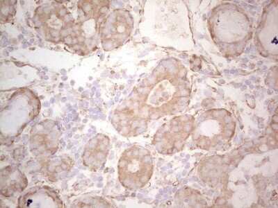 Immunohistochemistry: Ephrin-A3 Antibody (OTI4A4) [NBP2-46484]