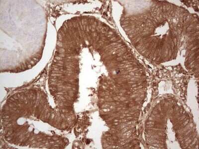 Immunohistochemistry: Ephrin-A3 Antibody (OTI4A4) [NBP2-46484]