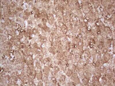 Immunohistochemistry: Ephrin-A3 Antibody (OTI4A4) [NBP2-46484]