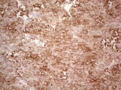 Immunohistochemistry: Ephrin-A3 Antibody (OTI4A4) [NBP2-46484]