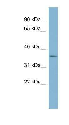 Western Blot: Ephrin-B1 Antibody [NBP1-59211]