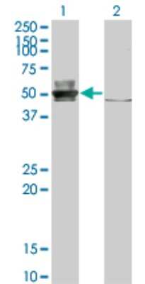 Western Blot: Epithelial Stromal Interaction 1 Antibody (2A8) [H00094240-M01]