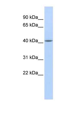 Western Blot: Epithelial Stromal Interaction 1 Antibody [NBP1-62209]