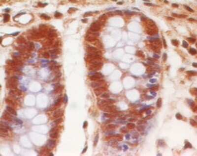 Immunohistochemistry-Paraffin: Eps8 Antibody (18F1F2) - Azide and BSA Free [NBP2-80723]