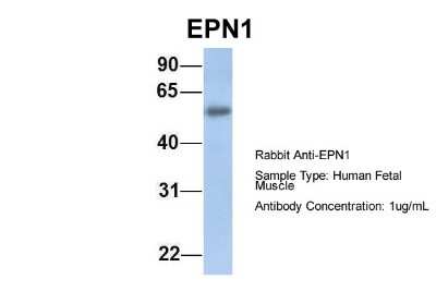 Western Blot: Epsin 1 Antibody [NBP1-56656]