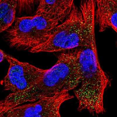 Immunocytochemistry/ Immunofluorescence: Epsin-2 Antibody [NBP2-58740]