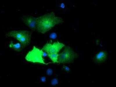Immunocytochemistry/ Immunofluorescence: Epsin-2 Antibody (OTI1G3) - Azide and BSA Free [NBP2-71701]