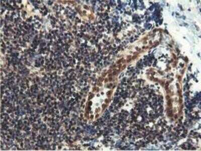 Immunohistochemistry: Epsin-2 Antibody (OTI1G3) - Azide and BSA Free [NBP2-71701]