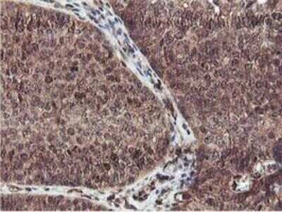 Immunohistochemistry-Paraffin: Epsin-2 Antibody (OTI1G3) [NBP2-01775]