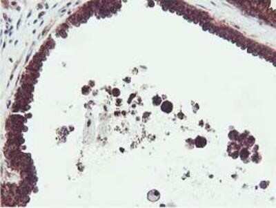 Immunohistochemistry-Paraffin: Epsin-2 Antibody (OTI1G3) [NBP2-01775]