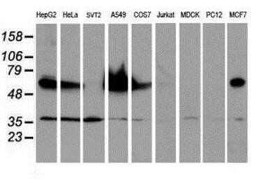 Western Blot: Epsin-2 Antibody (OTI1G3) [NBP2-01775]