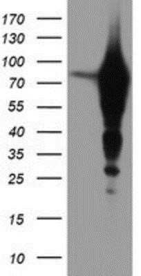 Western Blot: Epsin-2 Antibody (OTI1G3) [NBP2-01775]