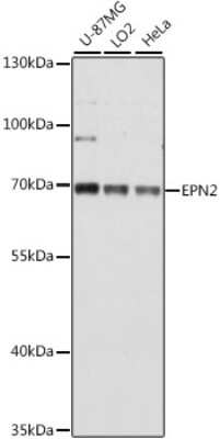 Western Blot: Epsin-2 AntibodyAzide and BSA Free [NBP3-03347]