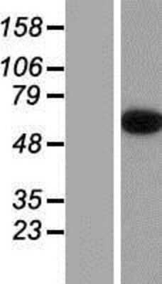 Western Blot: Epsin-2 Overexpression Lysate [NBP2-05424]