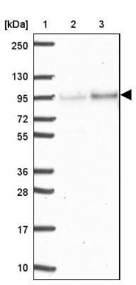 Western Blot: Epsin 3 Antibody [NBP2-49188]