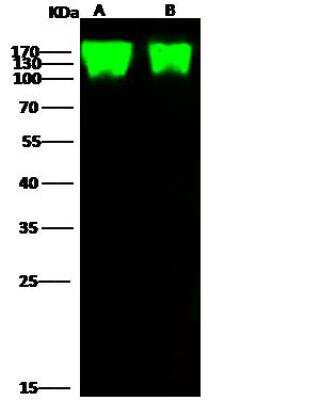 Western Blot: Epstein Barr Virus gp350 Protein Antibody [NBP3-12752]