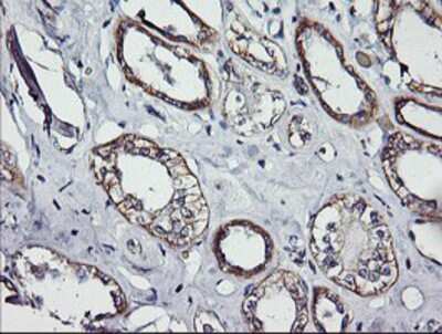 Immunohistochemistry-Paraffin: ErbB2/Her2 Antibody (OTI4F10) [NBP2-01152]