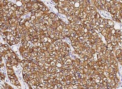 Immunohistochemistry-Paraffin: ErbB2/Her2 Antibody (002) [NBP2-89184]