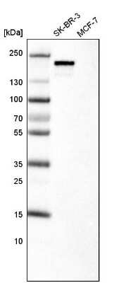 Western Blot: ErbB2/Her2 Antibody (CL0268) [NBP2-52896]