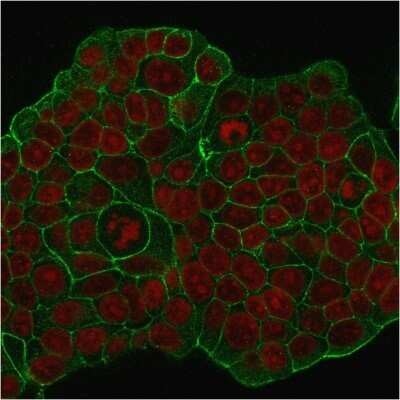 Immunocytochemistry/ Immunofluorescence: ErbB2/Her2 Antibody (ERB2/776) - Azide and BSA Free [NBP2-48004]