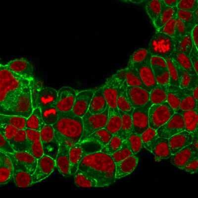 Immunocytochemistry/ Immunofluorescence: ErbB2/Her2 Antibody (ERB2/776) [NBP2-44983]