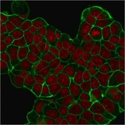 Immunocytochemistry/ Immunofluorescence: ErbB2/Her2 Antibody (HRB2/451) - Azide and BSA Free [NBP2-33064]