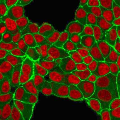 Immunocytochemistry/ Immunofluorescence: ErbB2/Her2 Antibody (HRB2/451) [NBP2-29437]