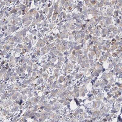 Immunohistochemistry-Paraffin: ErbB2/Her2 Antibody [NBP1-84584]
