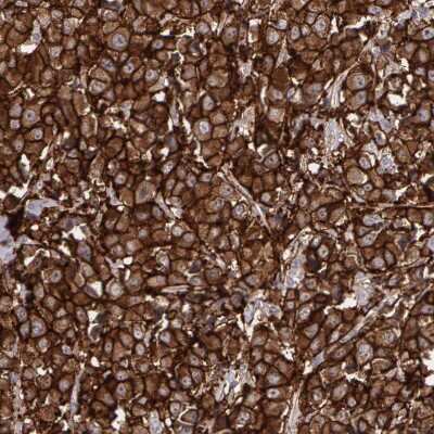 Immunohistochemistry-Paraffin: ErbB2/Her2 Antibody [NBP1-84584]