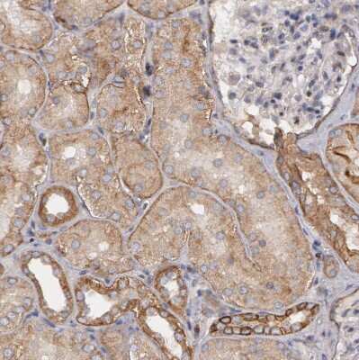 Immunohistochemistry-Paraffin: ErbB2/Her2 Antibody [NBP1-84584]