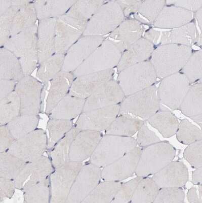 Immunohistochemistry-Paraffin: ErbB2/Her2 Antibody [NBP1-84584]