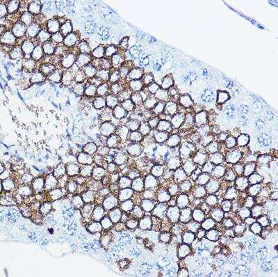 Immunohistochemistry-Paraffin: ErbB2/Her2 Antibody - BSA Free [NBP3-02960]