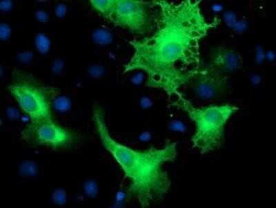 Immunocytochemistry/ Immunofluorescence: ErbB2/Her2 Antibody (OTI4F10) - Azide and BSA Free [NBP2-70653]