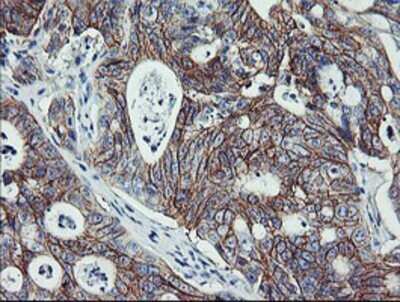 Immunohistochemistry: ErbB2/Her2 Antibody (OTI4F10) - Azide and BSA Free [NBP2-70653]