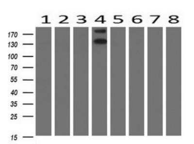 Western Blot: ErbB2/Her2 Antibody (OTI4F10)Azide and BSA Free [NBP2-70653]