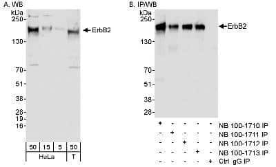 Western Blot: ErbB2/Her2 Antibody [NB100-1710]