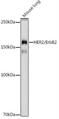 Western Blot: ErbB2/Her2 AntibodyBSA Free [NBP3-02960]