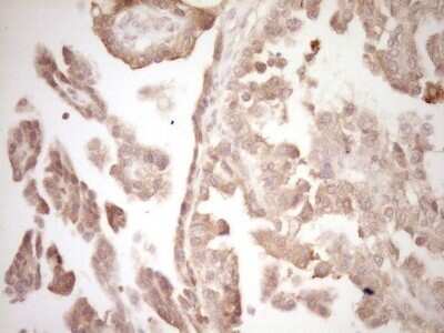 Immunohistochemistry: ErbB3/Her3 Antibody (OTI3E10) - Azide and BSA Free [NBP2-70661]