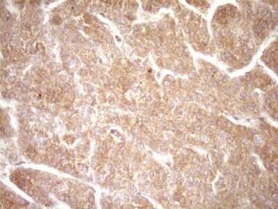 Immunohistochemistry: ErbB3/Her3 Antibody (OTI3E10) - Azide and BSA Free [NBP2-70661]