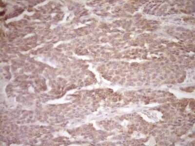 Immunohistochemistry: ErbB3/Her3 Antibody (OTI3E10) - Azide and BSA Free [NBP2-70661]