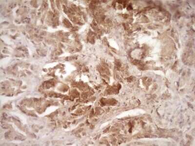 Immunohistochemistry: ErbB3/Her3 Antibody (OTI3E10) - Azide and BSA Free [NBP2-70661]