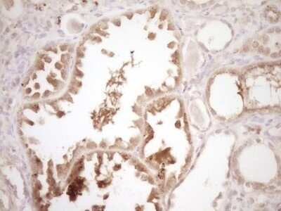 Immunohistochemistry: ErbB3/Her3 Antibody (OTI3E10) - Azide and BSA Free [NBP2-70661]