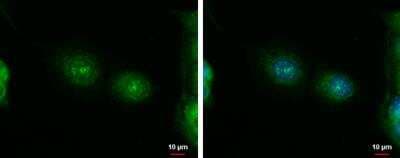 Immunocytochemistry/ Immunofluorescence: ErbB4/Her4 Antibody [NBP1-33120]